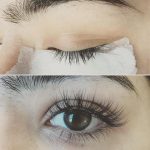 Cách Xử Lý Khi Dị Ứng Keo Nối Mi Đơn Giản Và Nhanh Chóng